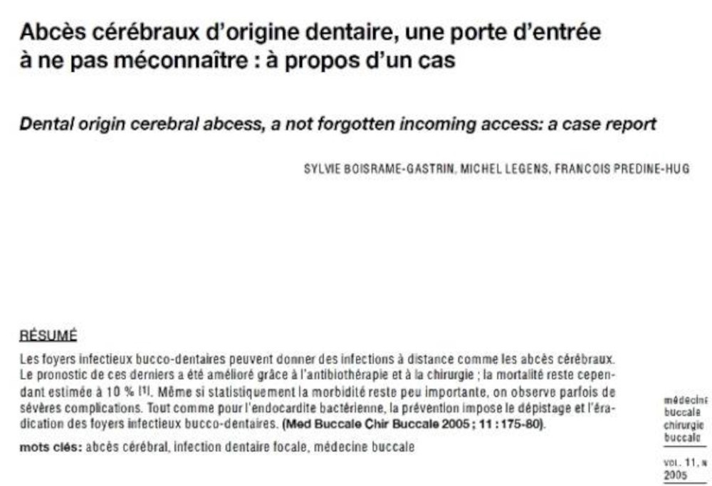 Informations patients abcès cérébral d’origine dentaire