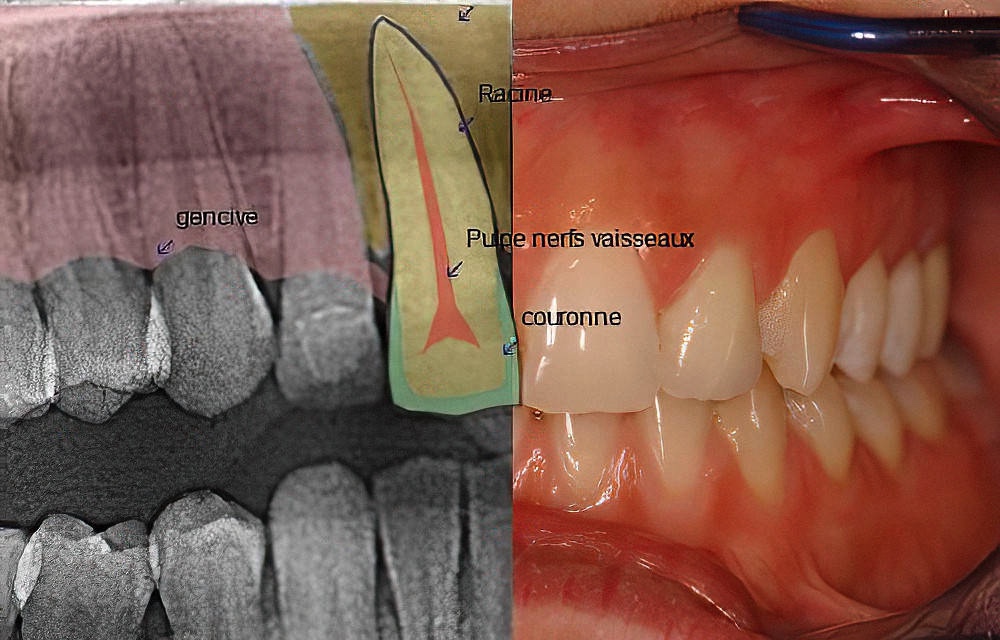 Informations patients dentiste Strasbourg anatomie dentaire