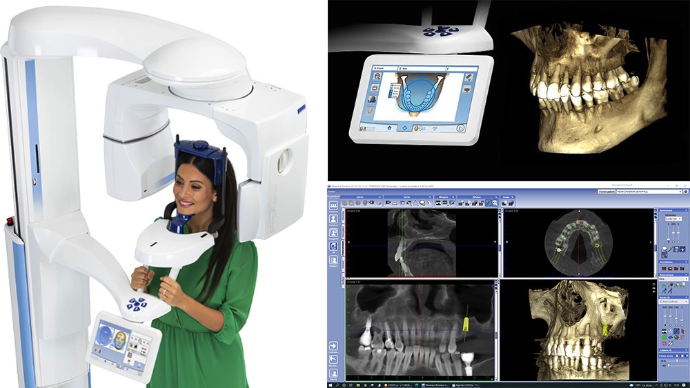 cabinet dentaire Strasbourg centre scanner 3D