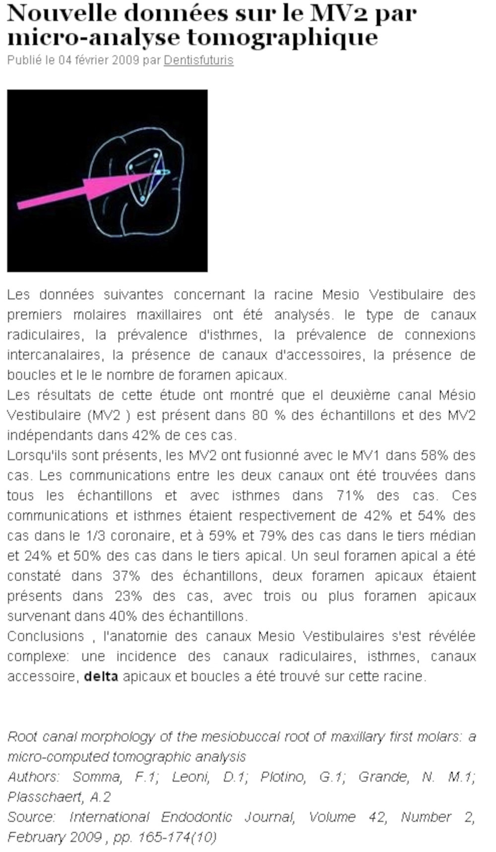 traitement racine dentaire miscroscope